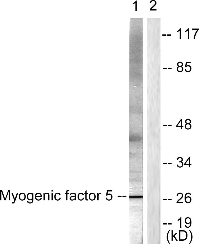MYF5 / MYF 5 Antibody (p49)