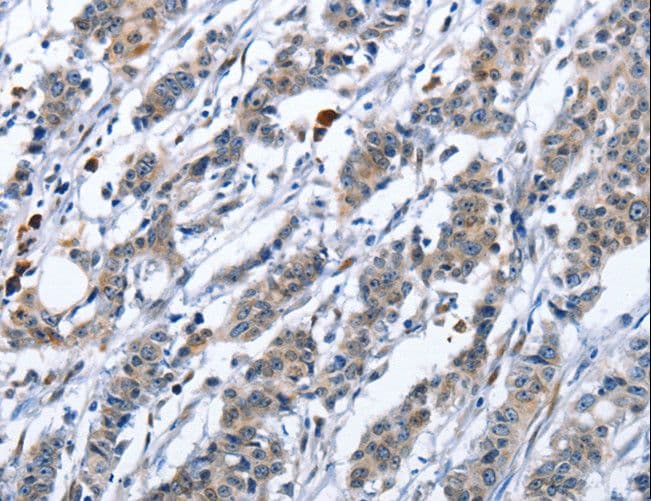 TNFRSF9 / 4-1BB / CD137 Antibody