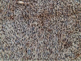 RBP1 / CRBP Antibody (clone OTI2H3)