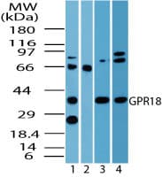 GPCRW / GPR18 Antibody (aa1-50)