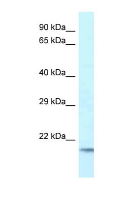 Polyclonal Rabbit anti-Human UEV1 / UEV1A Antibody (C-Terminus, WB)