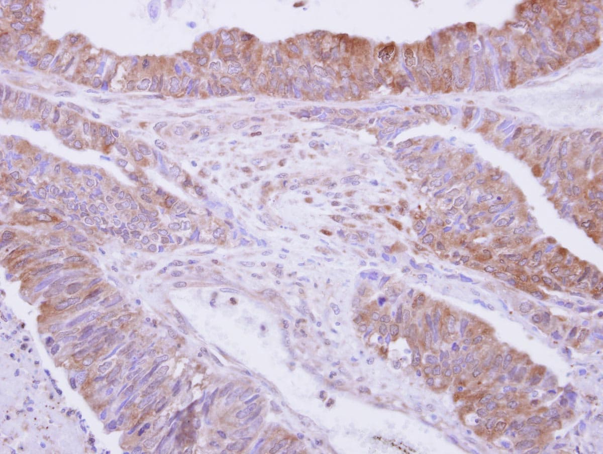 DBN1 / Drebrin Antibody