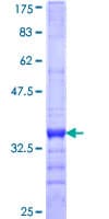 Human MMP28 Protein (Recombinant GST, N-terminus)