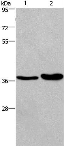 FUT1 / HSC Antibody