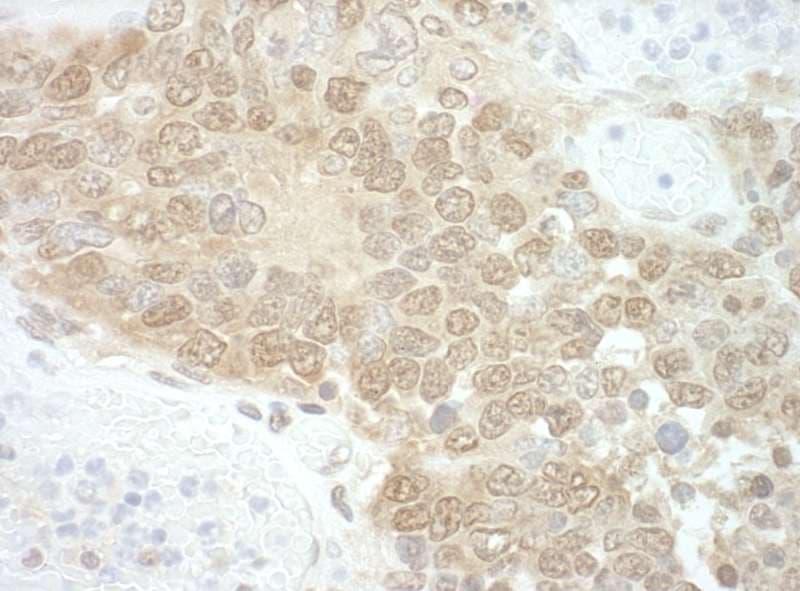 Polyclonal Rabbit anti-Human TIP48 / RUVBL2 Antibody (aa1-50, IHC)