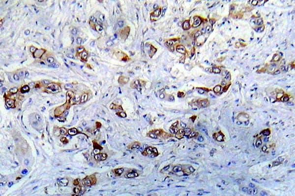 CAMK2A / CaMKII Alpha Antibody (Lys292)