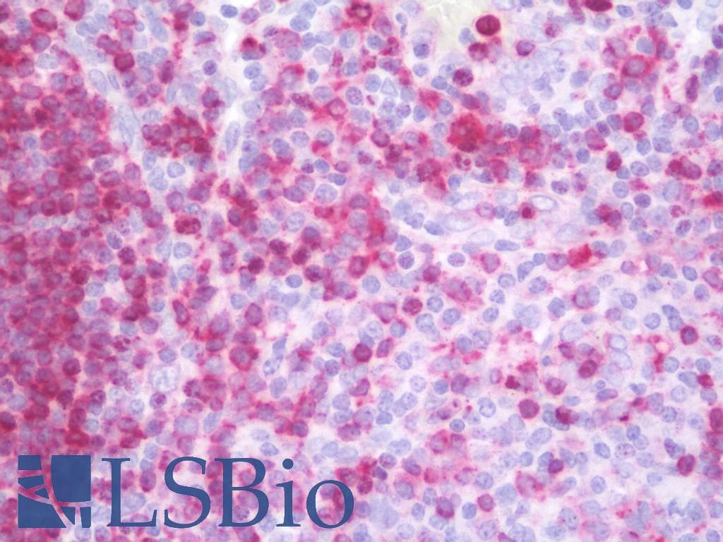 PathPlus™ Monoclonal Mouse anti-Human CD74 / CLIP Antibody (clone M-B741, Azide-free, IHC)