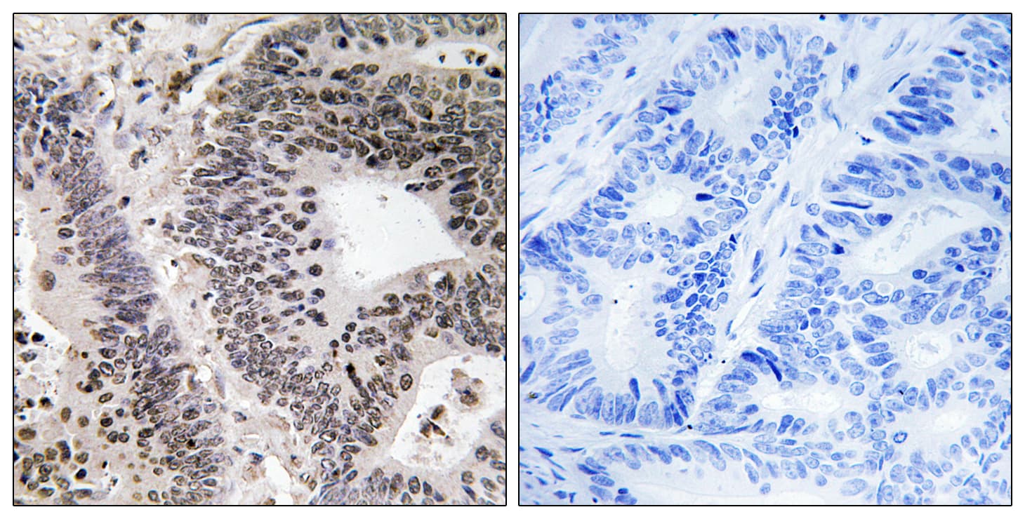 Polyclonal Rabbit anti-Human WWOX Antibody (phospho-Tyr33, IHC, WB)