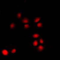 Polyclonal Rabbit anti-Human p14ARF / CDKN2A Antibody (Internal, IHC, IF, WB)