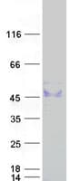 Human ST3GAL1 Protein (Recombinant Myc-DDK (Flag))
