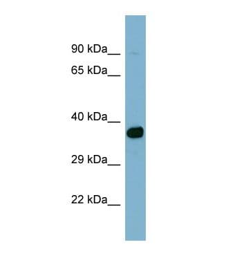 ACSM2A / MACS2 Antibody (aa121-170)