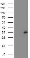 SIRT5 / Sirtuin 5 Antibody (clone OTI 1G5)