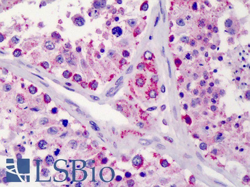 IHC-plus™ Polyclonal Rabbit anti-Human LIN28B Antibody (aa1-30, IHC, IF, WB)