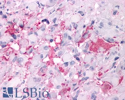 PathPlus™ Polyclonal Rabbit anti-Human GPR34 Antibody (Cytoplasmic Domain, IHC)