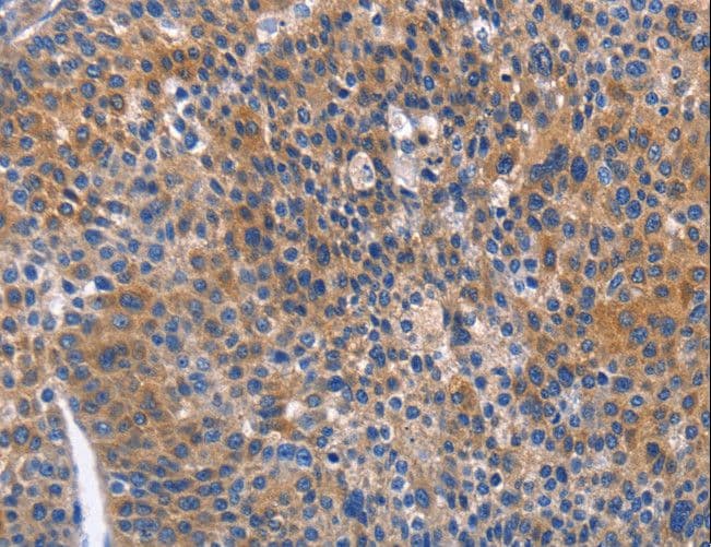 Polyclonal Rabbit anti-Human ARRB1 / Beta Arrestin 1 Antibody (IHC)