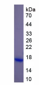 Human DHH / Desert Hedgehog Protein (Recombinant His)