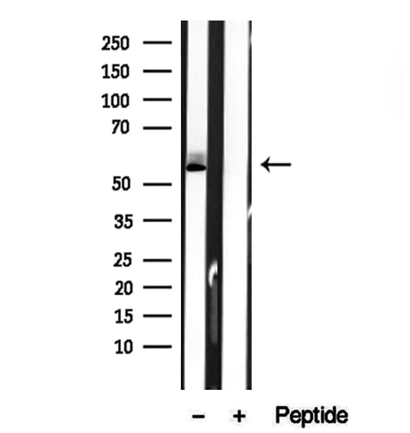 Polyclonal Rabbit anti-Human BCO2 / BCDO2 Antibody (IHC, IF, WB)