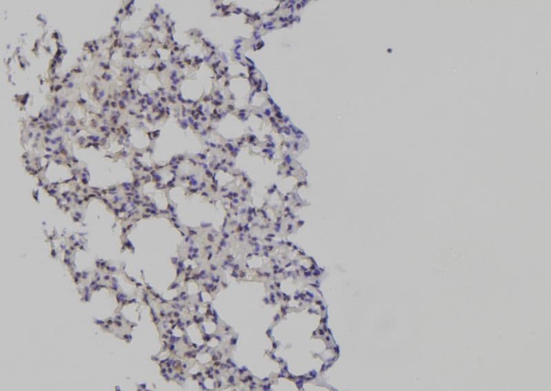 HIST3H3 Antibody (Methyl-Lys27)