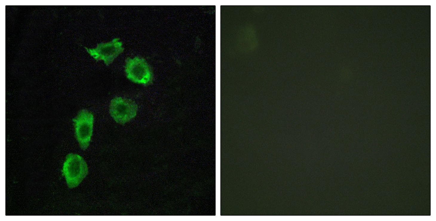 ADGRA1 / GPR123 Antibody