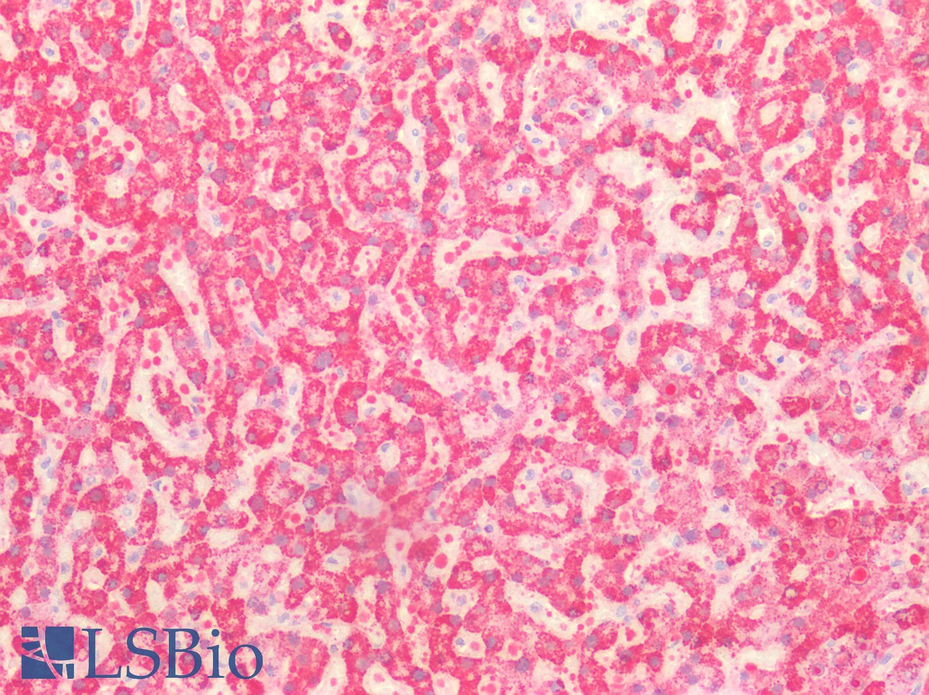 Polyclonal Rabbit anti-Human MPST Antibody (aa68-278, IHC, WB)