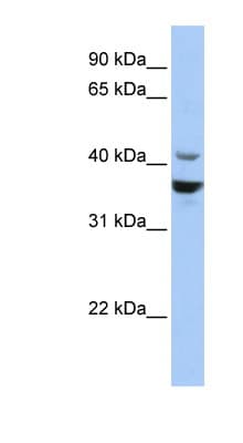 NEUROD1 Antibody (C-Terminus)