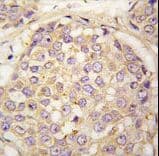 MAGEA4 Antibody (aa9-38)
