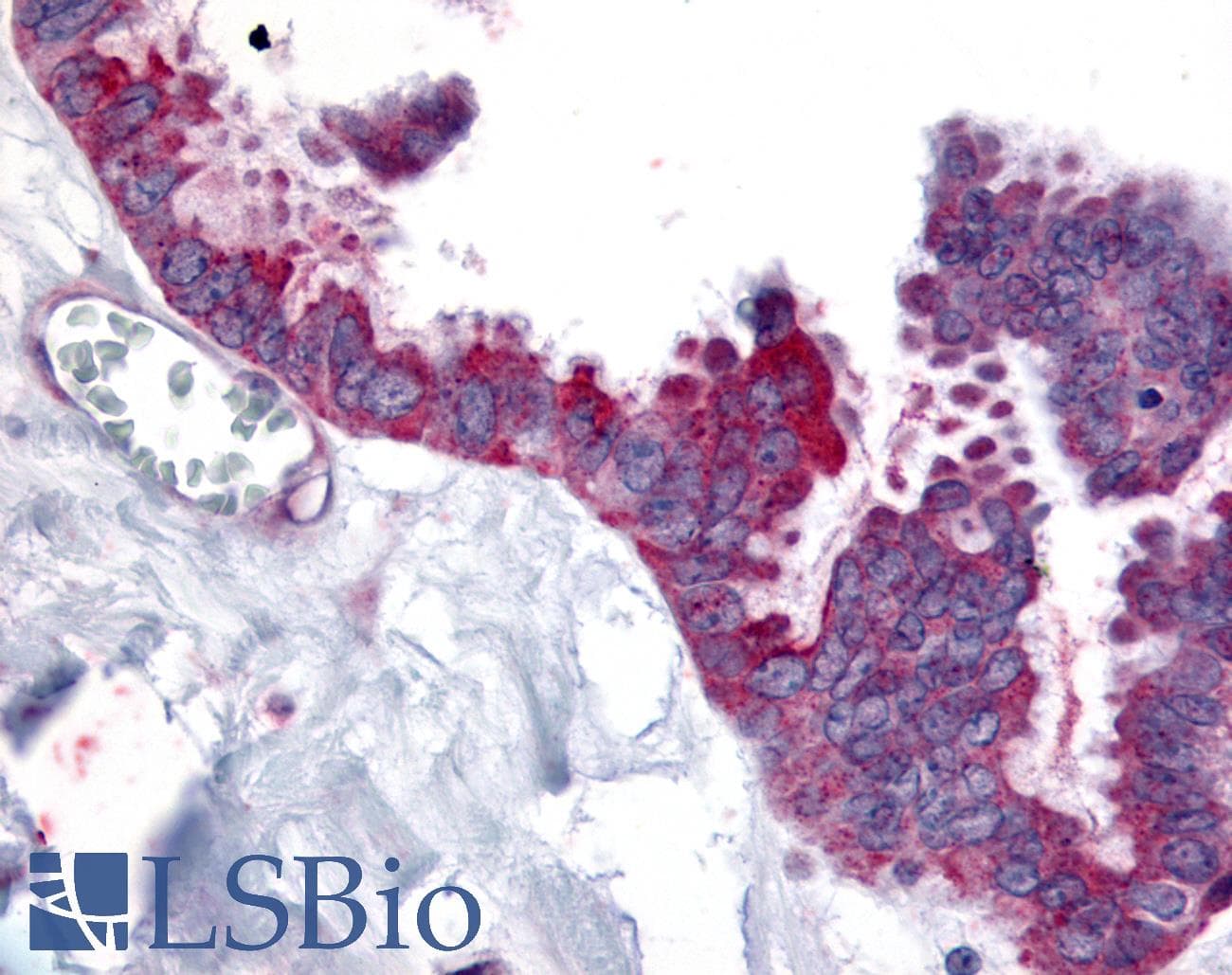 IHC-plus™ WNT2B Antibody (N-Terminus)