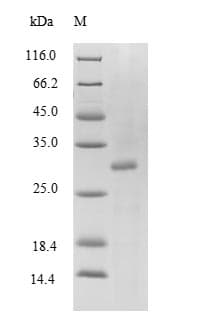 Mouse TTR / Transthyretin Protein (Recombinant 6His-SUMO, N-terminus)