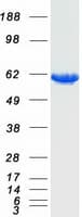 Human PKLR Protein (Recombinant Myc-DDK (Flag))
