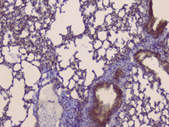 SLC34A2 / NaPi-2b Antibody