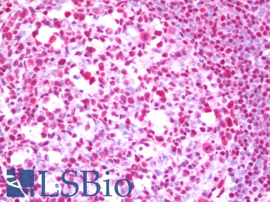 IHC-plus™ RPA2 / RFA2 / RPA34 Antibody (aa225-C-term)
