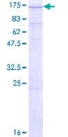 Human ZHX1 Protein (Recombinant GST)