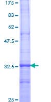 Human TRPC1 Protein (Recombinant GST, N-terminus)
