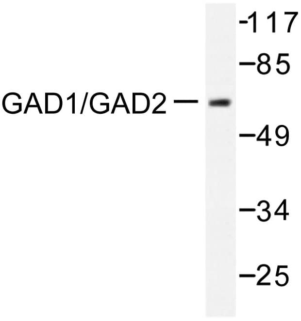 GAD65 Antibody (Asp572)