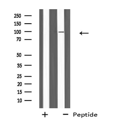 PLA2G6 / IPLA2 Antibody