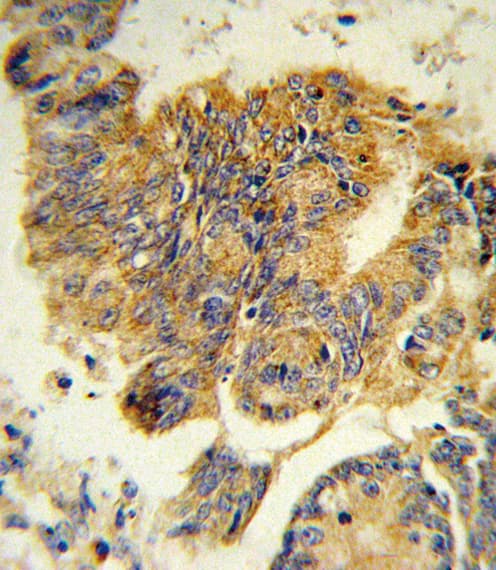 Polyclonal Rabbit anti-Human CSF3R / CD114 Antibody (aa252-280, IHC, WB)