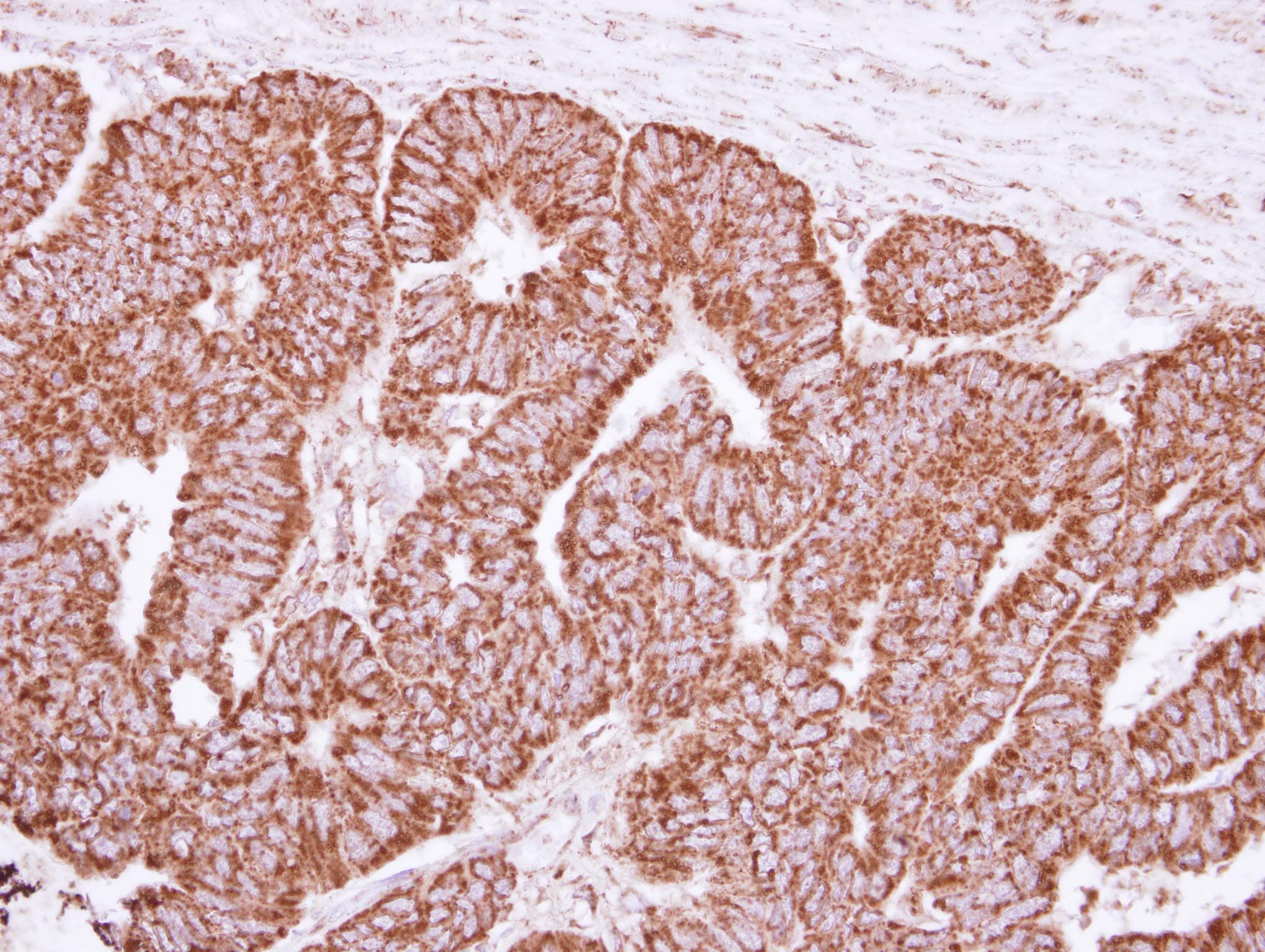 Polyclonal Rabbit anti-Human PPIF / Cyclophilin F Antibody (IHC, IF, WB)