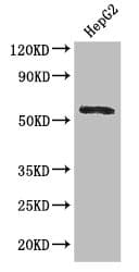 Polyclonal Rabbit anti-Human DDX6 Antibody (IHC, IF, WB)