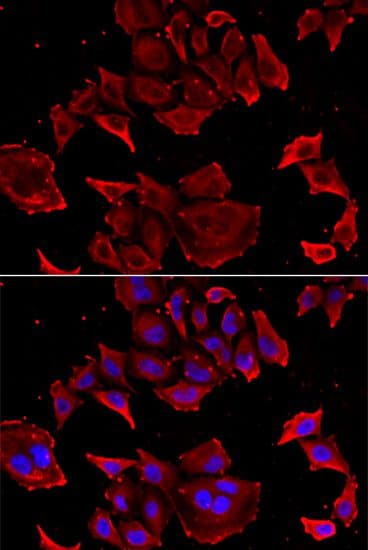 Polyclonal Rabbit anti-Human TCAP / Telethonin Antibody (IF, WB)
