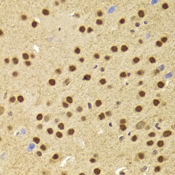 PHAP1 / ANP32A Antibody