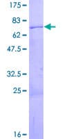 Human SMARCB1 / INI1 Protein (Recombinant GST)