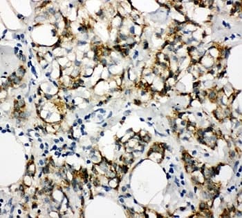 Polyclonal Rabbit anti-Human KRT8 / CK8 / Cytokeratin 8 Antibody (aa127-145, IHC, WB)