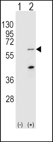 Polyclonal Rabbit anti-Human PINK1 Antibody (aa118-147, IHC, WB)