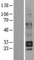 TPSB2 Protein (Over-Expression Lysate Myc-DDK (Flag))