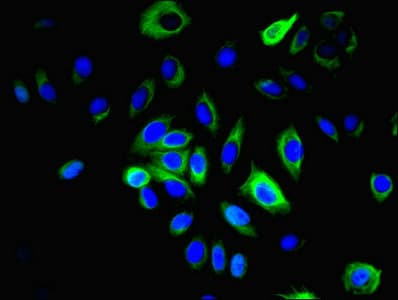 LRRN2 / GAC1 Antibody
