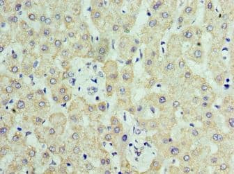 C14orf166 Antibody (aa1-244)