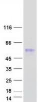 Human SERPINA11 Protein (Recombinant Myc-DDK (Flag))