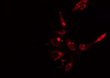 INPP5D / SHIP1 / SHIP Antibody