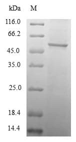 Human TAF11 Protein (Recombinant GST, N-terminus)