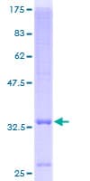 Human SLC39A3 / ZIP3 Protein (Recombinant GST)